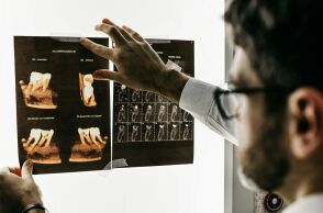 Πέντε ανεπαίσθητα συμπτώματα που οι οδοντίατροι λένε ότι δεν πρέπει ποτέ να αγνοήσετε