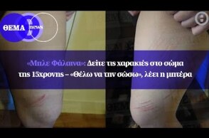 «Μπλε Φάλαινα»: Δείτε τις χαρακιές στο σώμα της 15χρονης – «Θέλω να την σώσω», λέει η μητέρα