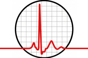 κόκκινη γραμμή 434