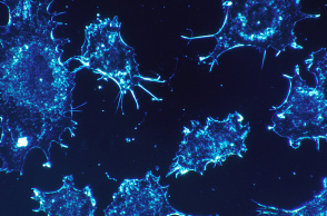 cancer-cells-541954_1920.jpg