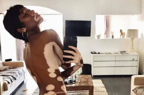 Winnie Harlow για το Sports Illustrated 