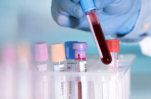 Τεστ αίματος