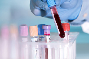 Εξέταση αίματος