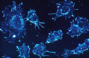 cancer-cells-541954_1920.jpg