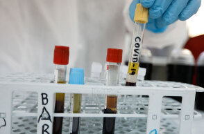 Κορωνοϊός στην Ελλάδα