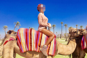 Η 34χρονη Ιωάννα που δέχθηκε επίθεση με βιτριόλι 