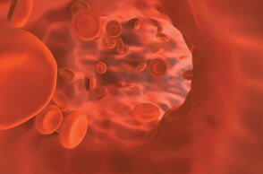 Νεότερα θεραπευτικά δεδομένα για ενήλικες ασθενείς με β-θαλασσαιμία