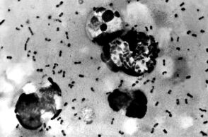 Βακτήρια βουβωνικής πανώλης 