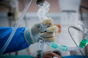 Μονάδα Εντατικής Θεραπείας (MΕΘ)