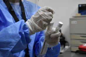 Τεστ κορωνοϊού