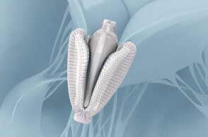 Διαδερμικές επιδιορθώσεις τριγλώχινας βαλβίδας