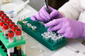 Εμπόδια στην πρόσβαση ασθενών με HIV στις απαραίτητες εξετάσεις 