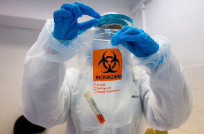 Έλεγχος δείγματος για κορωνοϊό