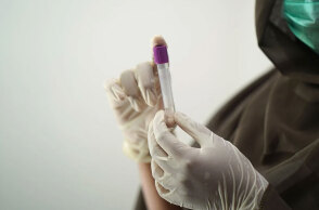 Κλινική μελέτη για τον κορωνοϊό και τη θεραπεία κατά της Covid-19 (ΦΩΤΟ ΑΡΧΕΙΟΥ)