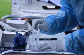 ΕΟΔΥ - Τεστ για κορωνοϊό