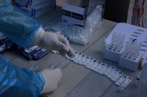 ΕΟΔΥ - Τεστ για κορωνοϊό