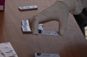 ΕΟΔΥ - Τεστ για κορωνοϊό