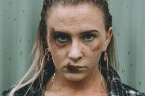 Κακοποιημένη γυναίκα