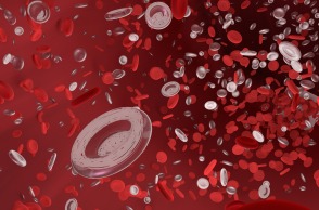 Έγκριση θεραπείας για την οξεία μυελογενή λευχαιμία