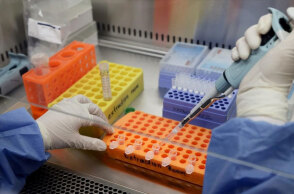 Τα μονοκλωνικά αντισώματα θα χορηγούνται σε ασθενείς με κορωνοϊό από την Παρασκευή 26 Νοεμβρίου 2021 σε 10 νοσοκομεία στην Ελλάδα (ΦΩΤΟ ΑΡΧΕΙΟΥ)