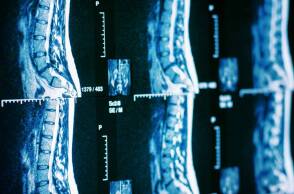 Εφαρμογή της ρομποτικής χειρουργικής της σπονδυλικής στήλης