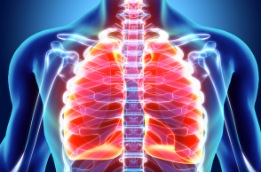 Καρκίνος του πνεύμονα: Ελάχιστα επεμβατική χειρουργική