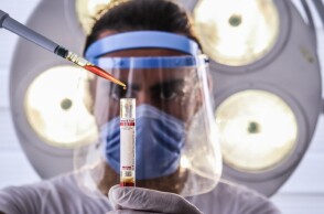 Υπό ανάπτυξη ένα απλό τεστ DNA που μπορεί να ανιχνεύσει ταυτόχρονα πολλές νευρολογικές παθήσεις με γενετική αιτιολογία