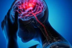 Βλάβες του εγκεφάλου: Αντιμετώπιση με ενδοαγγειακή χειρουργική 