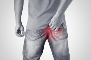 Βοηθάει η αποτρίχωση με λέιζερ στην κύστη κόκκυγα;