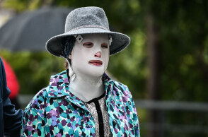 Η Ιωάννα Παλιοσπύρου με τη μάσκα στο πρόσωπο μετά την επίθεση με βιτριόλι