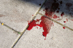 Στο κεφάλι με το αντικλεπτικό του τιμονιού χτύπησε 20χρονο ένας 55χρονος οδηγός στη Νέα Φιλαδέλφεια