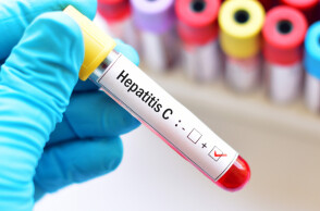 hepatitis-s.jpg