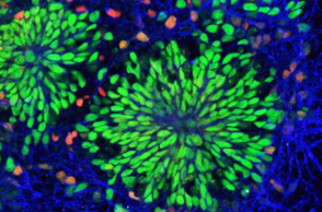 Νευρογένεση και Μνήμη