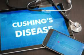 Ένα βήμα πιο κοντά στην έγκαιρη θεραπεία του συνδρόμου Cushing