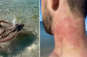 Αυστραλία: Το «πιο θυμωμένο χταπόδι» επιτίθεται σε τουρίστα 