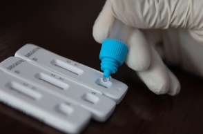 Δωρεάν rapid test από κλιμάκια του ΕΟΔΥ