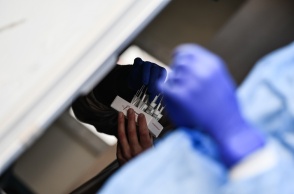 Δωρεάν rapid test από κλιμάκια του ΕΟΔΥ