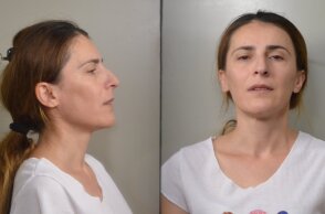 Η οικιακή βοηθός που ξάφριζε σπίτια στα Νότια Προάστια