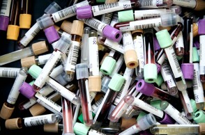 Εξετάσεις αίματος