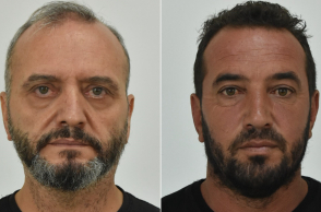 Ο 53χρονος Ηλίας Μίχος και ο 42χρονος Γιάννης Σοφιανίδης βιαστές της 12χρονης στον Κολωνό