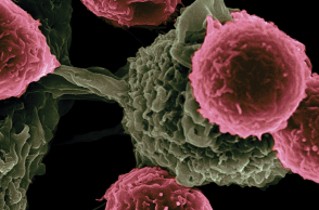 καρκίνος του πνεύμονα