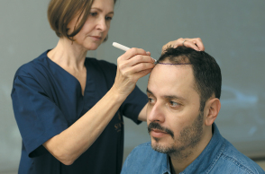 SENECA Medical Group: Σύμμαχός μας στη νικητήρια μάχη κατά της τριχόπτωσης