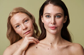 Πώς ο Σακχαρώδης Διαβήτης επηρεάζει την υγεία της επιδερμίδας σου