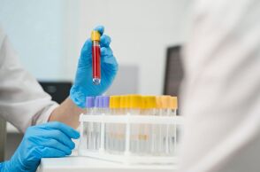 HIV: Υπογράφτηκε η Κοινή Υπουργική Απόφαση για την προληπτική χορήγηση αντιρετροϊκών φαρμάκων (PrEP) - Προϋποθέσεις και διαδικασία συνταγογράφησης.