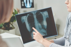 Καρκίνος του Πνεύμονα: Οι νέες θεραπευτικές προσεγγίσεις