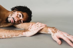 Τι είναι οι αυτοάνοσες ασθένειες και γιατί ακούμε γι’ αυτές όλο και περισσότερο