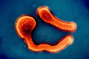 Ο γιατρός Γιώργος Παππάς μιλά για τον θανατηφόρο ιό Μάρμπουργκ