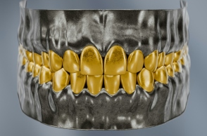 Τα λάθη που αλλοιώνουν το χρώμα των δοντιών μας 