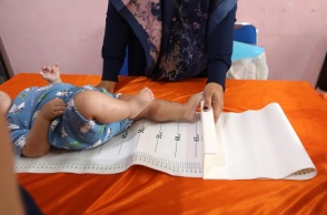 Μέτρηση ύψους σε μωρό