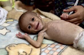 Γάζα: Η ιστορία πίσω από τη φωτογραφία του μόλις 6 μηνών μωρού που συγκλόνισε τον κόσμο
